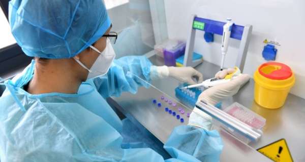 PCR-aankopen in China stegen maanden voordat de eerste bekende Covid-gevallen bekend waren
